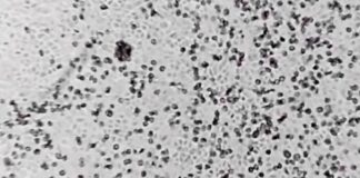 Coronavirus in Puglia, restano tre i casi di contagio. Nella Bat al via le “grandi pulizie” nelle scuole